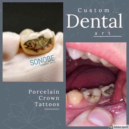 Custom Dental Art at Laurence Palmer, DDS