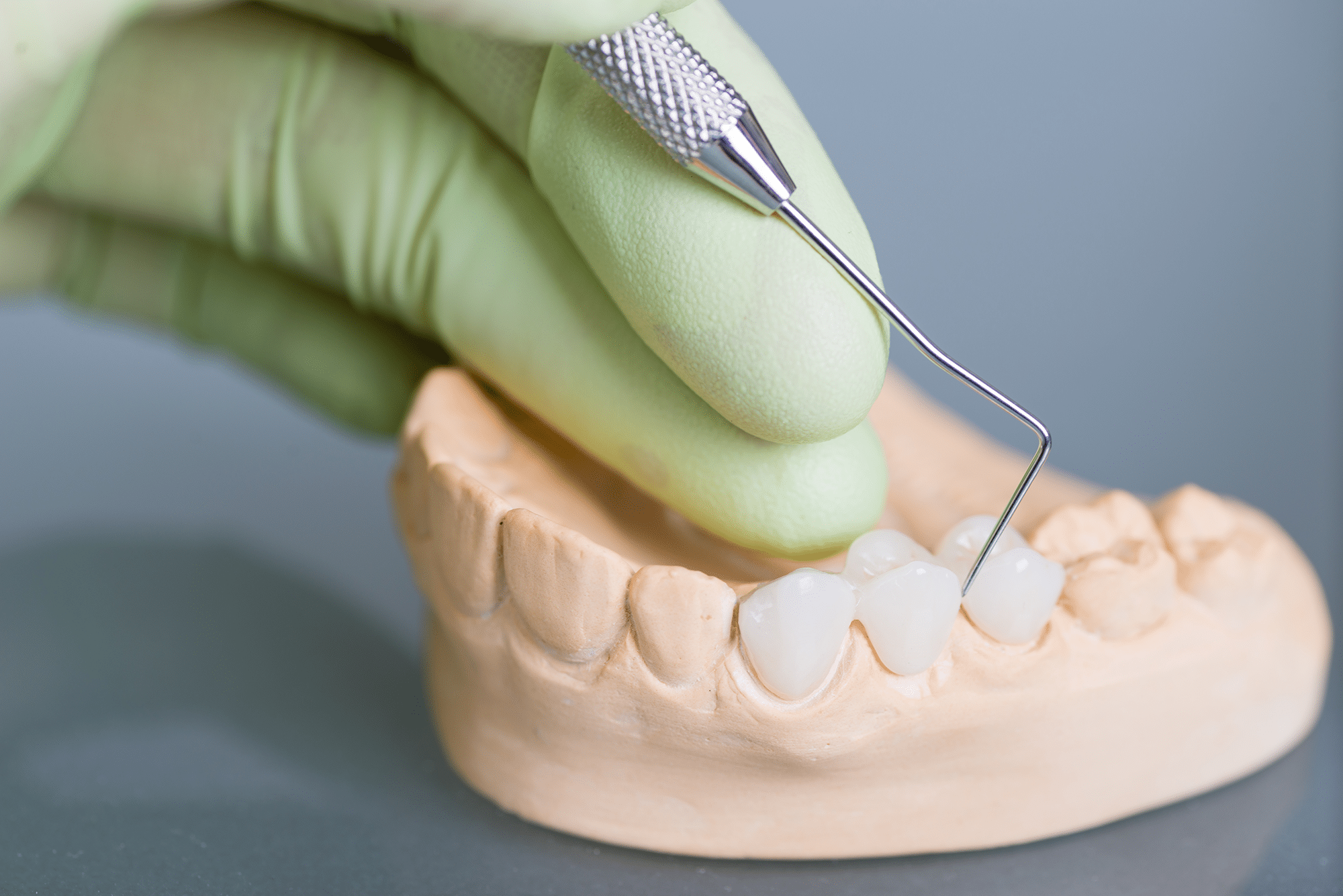 Dental Bridges at Laurence Palmer, DDS